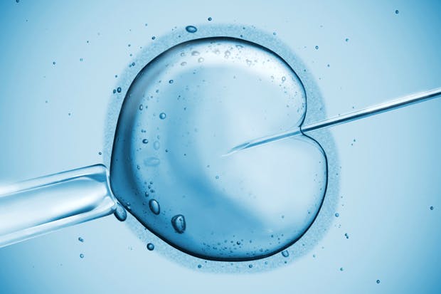 Why You May Need IVF