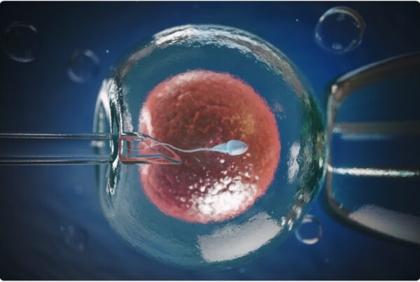 ivf