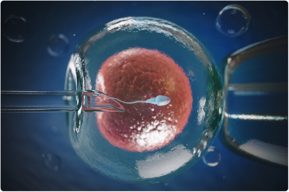 Why You Need IVF Treatment