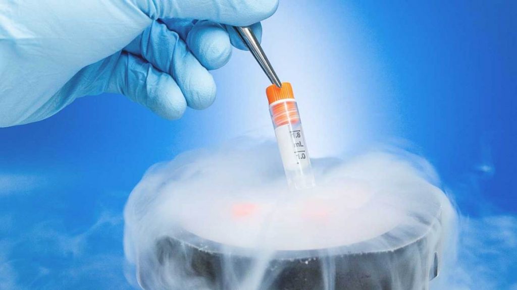 What You Should Know About Sperm Freezing