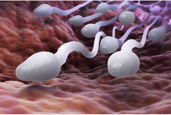 sperm fragmentation