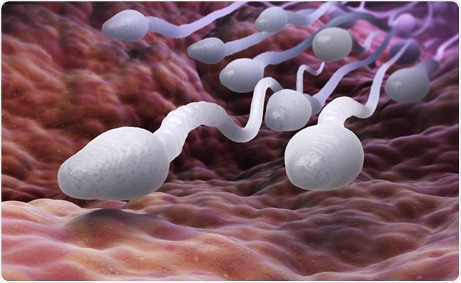 What You Should Know About Sperm DNA Fragmentation and Infertility